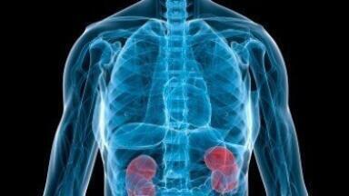 Kidney stone cases 'could increase with global temperatures'